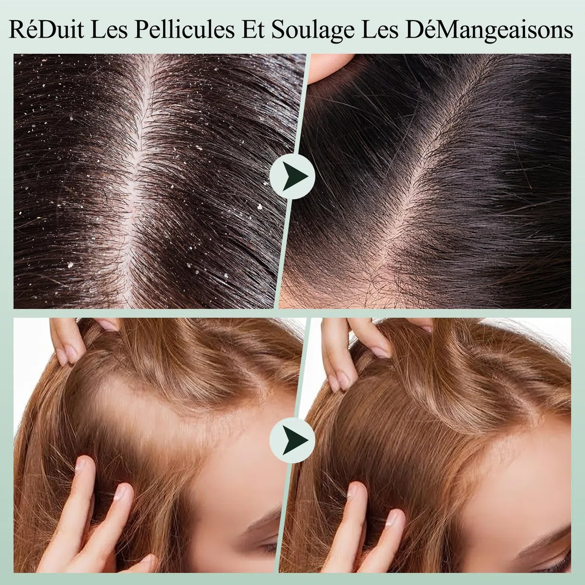 Gommage du cuir chevelu, shampooing exfoliant pour cuir chevelu au romarin, traitement 2 en 1 du cuir chevelu à l'huile de menthe, traitement capillaire pour clarifier et enlever l'accumulation avec