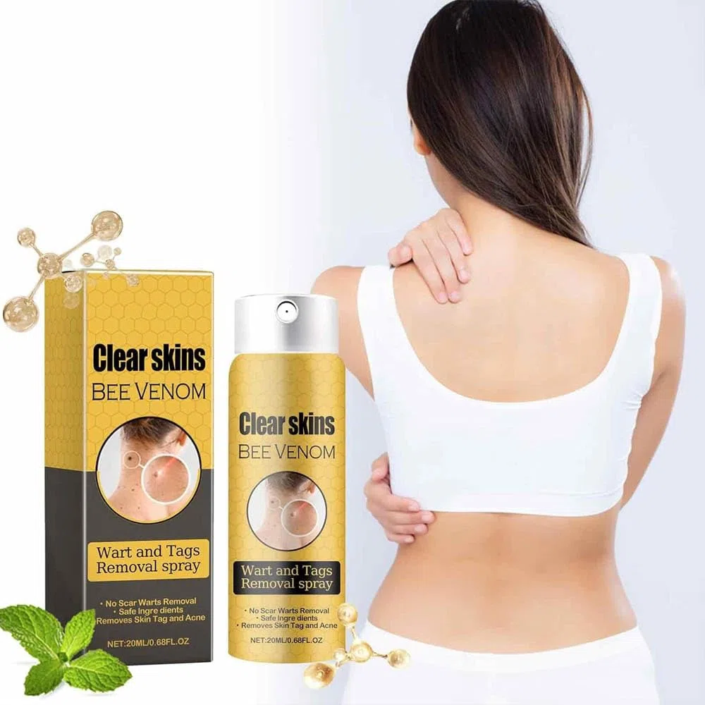 3Pcs Bee Venom Spray,Wart Removal Spray Skin Tag Removal Bee Venom Lymphatic Spray 0.67 fl.oz/20ml