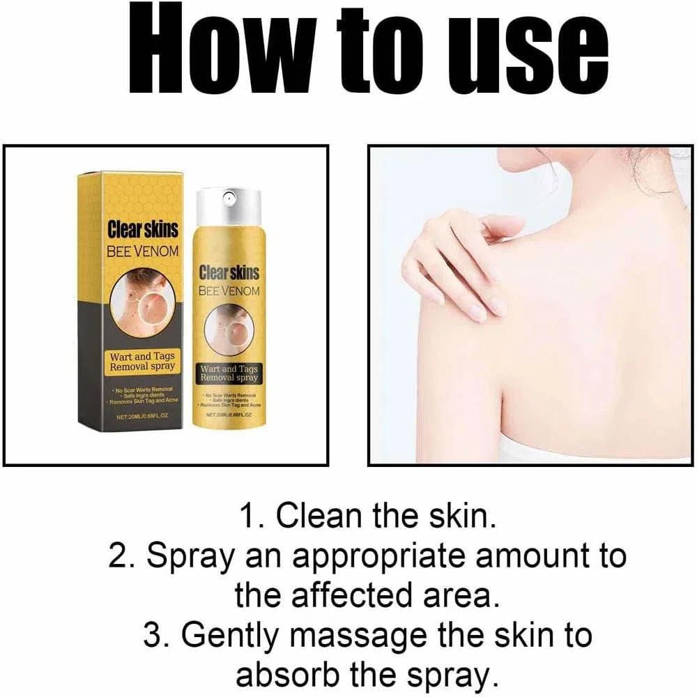 3Pcs Bee Venom Spray,Wart Removal Spray Skin Tag Removal Bee Venom Lymphatic Spray 0.67 fl.oz/20ml