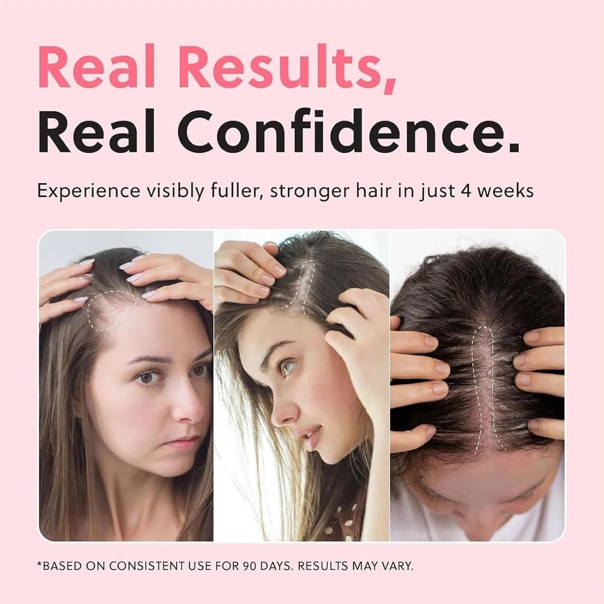 Hair Growth Oil Spray, Natural Hair Thinning Spray for Thinning Hair | Non-Greasy, Damage Repair, Loss Prevention (3PCS)