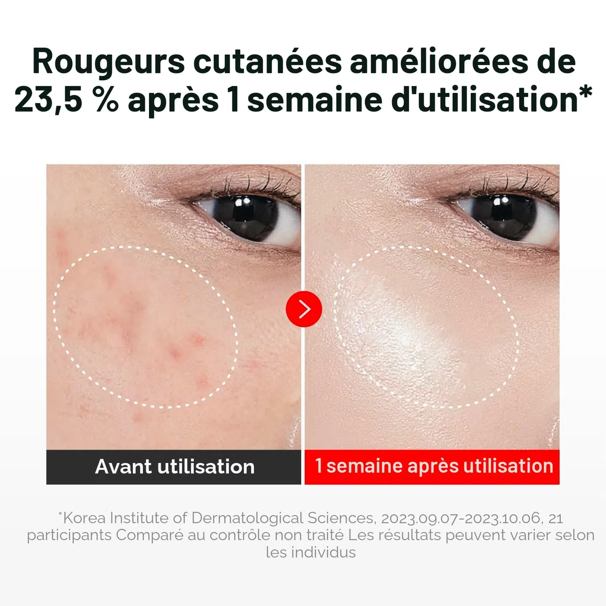 CENTELLIAN 24 Madeca Crème Time Reverse (50 ml) – Crème avancée à absorption rapide et nourrissante, hydrate, raffermit et réduit les rides, faible irritation, soin coréen de la peau