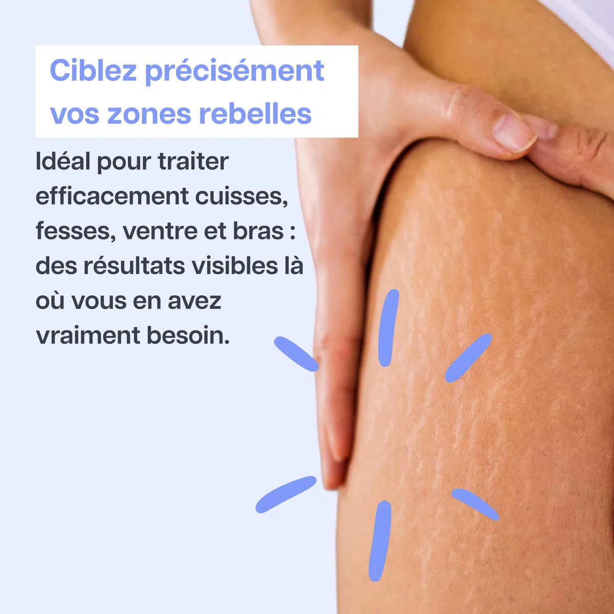 Masseur Anti-Cellulite et Vergetures 2-en-1 | Drainage Lymphatique et Palper-Rouler | Élimine Cellulite et Réduit Vergetures | Soin Corps Raffermissant | Usage facile à domicile