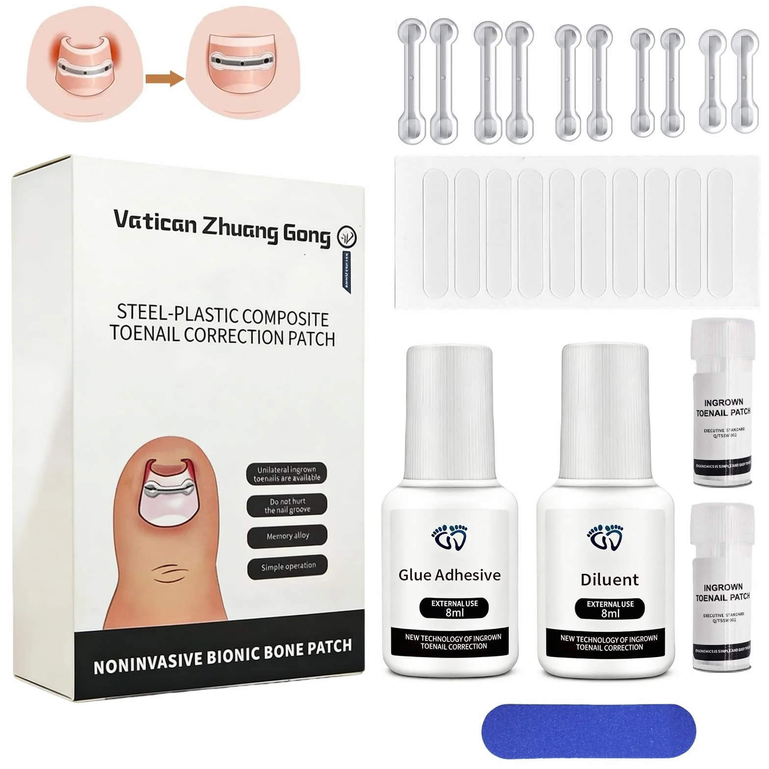 Correcteur Ongle Incarné,Correction Des Ongles Outils,Patch Correcteur D'Ongles D'Orteils,10Pcs Kit Ongle Incarné Gros Orteil,Nagelkorrekturspange pour Hhommes et Femmes, 16/17/18/19/20 mm